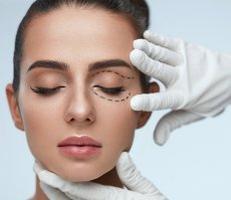 Eyelid Lift